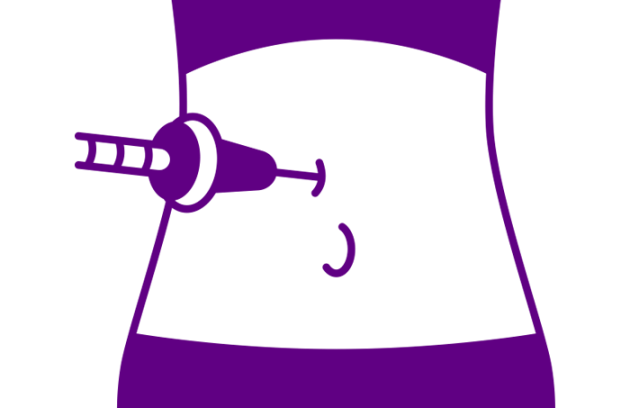 کربوکسی تراپی