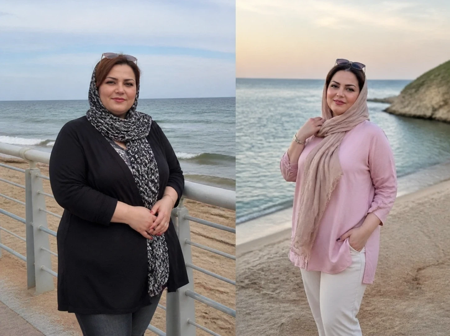 کاهش وزن قبل و بعد ایمپلنت لاغری
